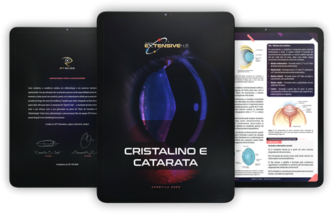 imagem apostila cirurgia refrativa